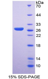 SOX2 Protein - Recombinant Sex Determining Region Y Box Protein 2 By SDS-PAGE