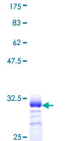 SOX21 Protein - 12.5% SDS-PAGE Stained with Coomassie Blue.