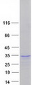 SOX21 Protein - Purified recombinant protein SOX21 was analyzed by SDS-PAGE gel and Coomassie Blue Staining