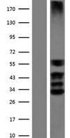 SOX3 Protein - Western validation with an anti-DDK antibody * L: Control HEK293 lysate R: Over-expression lysate