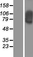 SOX30 Protein - Western validation with an anti-DDK antibody * L: Control HEK293 lysate R: Over-expression lysate