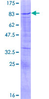 SOX30 Protein - 12.5% SDS-PAGE of human SOX30 stained with Coomassie Blue