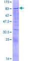 SOX30 Protein - 12.5% SDS-PAGE of human SOX30 stained with Coomassie Blue