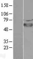 SOX4 Protein - Western validation with an anti-DDK antibody * L: Control HEK293 lysate R: Over-expression lysate