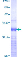SOX4 Protein - 12.5% SDS-PAGE Stained with Coomassie Blue.