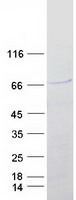 SOX4 Protein - Purified recombinant protein SOX4 was analyzed by SDS-PAGE gel and Coomassie Blue Staining
