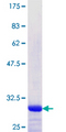 SOX5 Protein - 12.5% SDS-PAGE Stained with Coomassie Blue.
