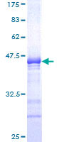 SOX6 Protein - 12.5% SDS-PAGE Stained with Coomassie Blue.