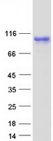 SOX6 Protein - Purified recombinant protein SOX6 was analyzed by SDS-PAGE gel and Coomassie Blue Staining
