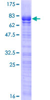 SOX7 Protein - 12.5% SDS-PAGE of human SOX7 stained with Coomassie Blue