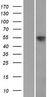 SOX8 Protein - Western validation with an anti-DDK antibody * L: Control HEK293 lysate R: Over-expression lysate