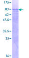 SOX8 Protein - 12.5% SDS-PAGE of human SOX8 stained with Coomassie Blue