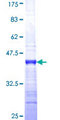 SOX8 Protein - 12.5% SDS-PAGE Stained with Coomassie Blue.