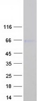 SOX8 Protein - Purified recombinant protein SOX8 was analyzed by SDS-PAGE gel and Coomassie Blue Staining