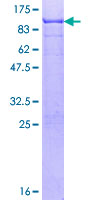 SOX9 Protein - 12.5% SDS-PAGE of human SOX9 stained with Coomassie Blue
