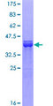 SOX9 Protein - 12.5% SDS-PAGE Stained with Coomassie Blue.