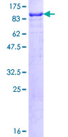 SP100 Protein - 12.5% SDS-PAGE of human SP100 stained with Coomassie Blue
