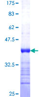 SP100 Protein - 12.5% SDS-PAGE Stained with Coomassie Blue.