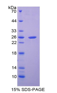 SP100 Protein - Recombinant Sp100 Nuclear Antigen By SDS-PAGE