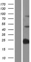 SP140 Protein - Western validation with an anti-DDK antibody * L: Control HEK293 lysate R: Over-expression lysate