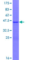 SP140 Protein - 12.5% SDS-PAGE of human SP140 stained with Coomassie Blue