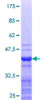 SP140 Protein - 12.5% SDS-PAGE Stained with Coomassie Blue.