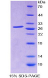 SP140 Protein - Recombinant Sp140 Nuclear Body Protein By SDS-PAGE