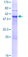 SP2 Protein - 12.5% SDS-PAGE of human SP2 stained with Coomassie Blue