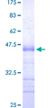 SP3 Protein - 12.5% SDS-PAGE Stained with Coomassie Blue.