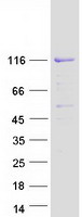 SP3 Protein - Purified recombinant protein SP3 was analyzed by SDS-PAGE gel and Coomassie Blue Staining