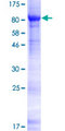 SP32 / ACRBP Protein - 12.5% SDS-PAGE of human ACRBP stained with Coomassie Blue