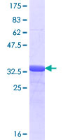 SP4 Protein - 12.5% SDS-PAGE Stained with Coomassie Blue.
