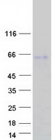 SP5 Protein - Purified recombinant protein SP5 was analyzed by SDS-PAGE gel and Coomassie Blue Staining