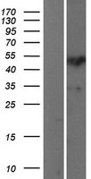 SP7 / Osterix Protein - Western validation with an anti-DDK antibody * L: Control HEK293 lysate R: Over-expression lysate
