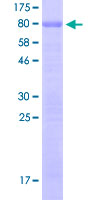 SP7 / Osterix Protein - 12.5% SDS-PAGE of human SP7 stained with Coomassie Blue