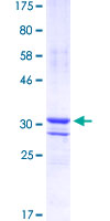 SP7 / Osterix Protein - 12.5% SDS-PAGE Stained with Coomassie Blue.