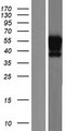 SP9 Protein - Western validation with an anti-DDK antibody * L: Control HEK293 lysate R: Over-expression lysate