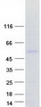 SP9 Protein - Purified recombinant protein SP9 was analyzed by SDS-PAGE gel and Coomassie Blue Staining