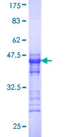 SPA17 / Sperm Protein 17 Protein - 12.5% SDS-PAGE Stained with Coomassie Blue.