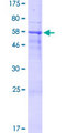 SPACA1 Protein - 12.5% SDS-PAGE of human SPACA1 stained with Coomassie Blue