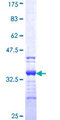 SPAG1 / TPIS Protein - 12.5% SDS-PAGE Stained with Coomassie Blue.