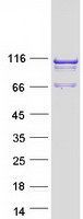 SPAG1 / TPIS Protein - Purified recombinant protein SPAG1 was analyzed by SDS-PAGE gel and Coomassie Blue Staining