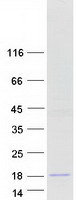 SPAG11B Protein - Purified recombinant protein SPAG11B was analyzed by SDS-PAGE gel and Coomassie Blue Staining