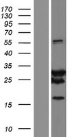 SPAG16 Protein - Western validation with an anti-DDK antibody * L: Control HEK293 lysate R: Over-expression lysate