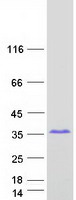 SPAG16 Protein - Purified recombinant protein SPAG16 was analyzed by SDS-PAGE gel and Coomassie Blue Staining
