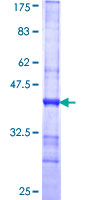 SPAG4 Protein - 12.5% SDS-PAGE Stained with Coomassie Blue.