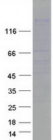 SPAG5 / MAP126 Protein - Purified recombinant protein SPAG5 was analyzed by SDS-PAGE gel and Coomassie Blue Staining