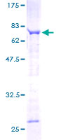 SPAG6 Protein - 12.5% SDS-PAGE of human SPAG6 stained with Coomassie Blue