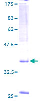 SPAG9 Protein - 12.5% SDS-PAGE of human SPAG9 stained with Coomassie Blue