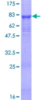 SPAM1 / PH20 Protein - 12.5% SDS-PAGE of human SPAM1 stained with Coomassie Blue